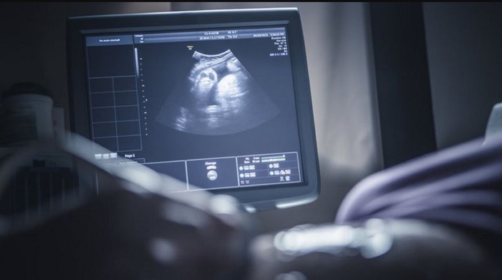 Si la paciente no tiene ovarios funcionales, no es posible desplazar el útero, porque no habría forma de nutrirlo | Foto Getty Images