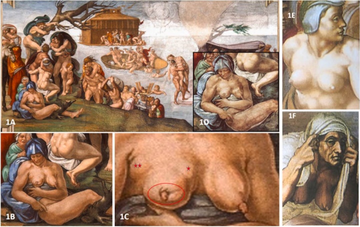 Miguel Ángel en Capilla Sixtina 1